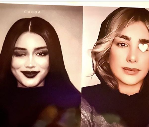 Two young women who lost an eye during Iran protests. Ghazal Ranjkesh (L) and Elahe Tavakolian