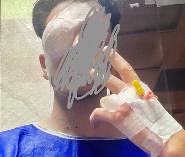 A protester blinded by birdshots (November 2022)