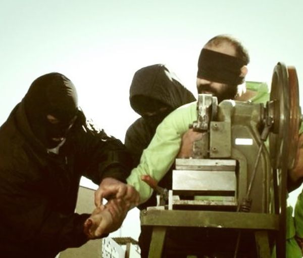 A prisoner amputated by a guillotine-like device (file photo)