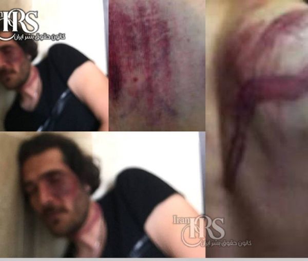 Photos showing Firouzi's injuries in custody. January 2023