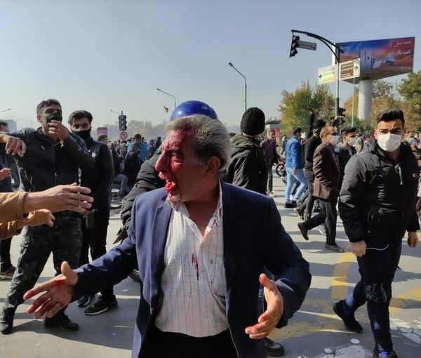 A man whose face is injured by shotgun pellets in Esfahan. November 26, 2021