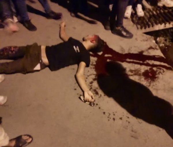 A protester injured by security forces in Rasht, the provincial capital of Gilan (September 2022)