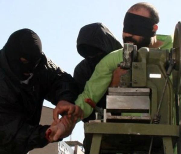 A prisoner about to be amputated by a guillotine-like device (file photo)